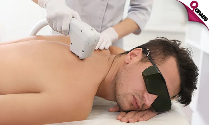 Laser Hair Removal for Men!